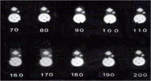 CC6