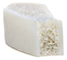 MatriGraft_Iliac Crest Wedge 2_burned